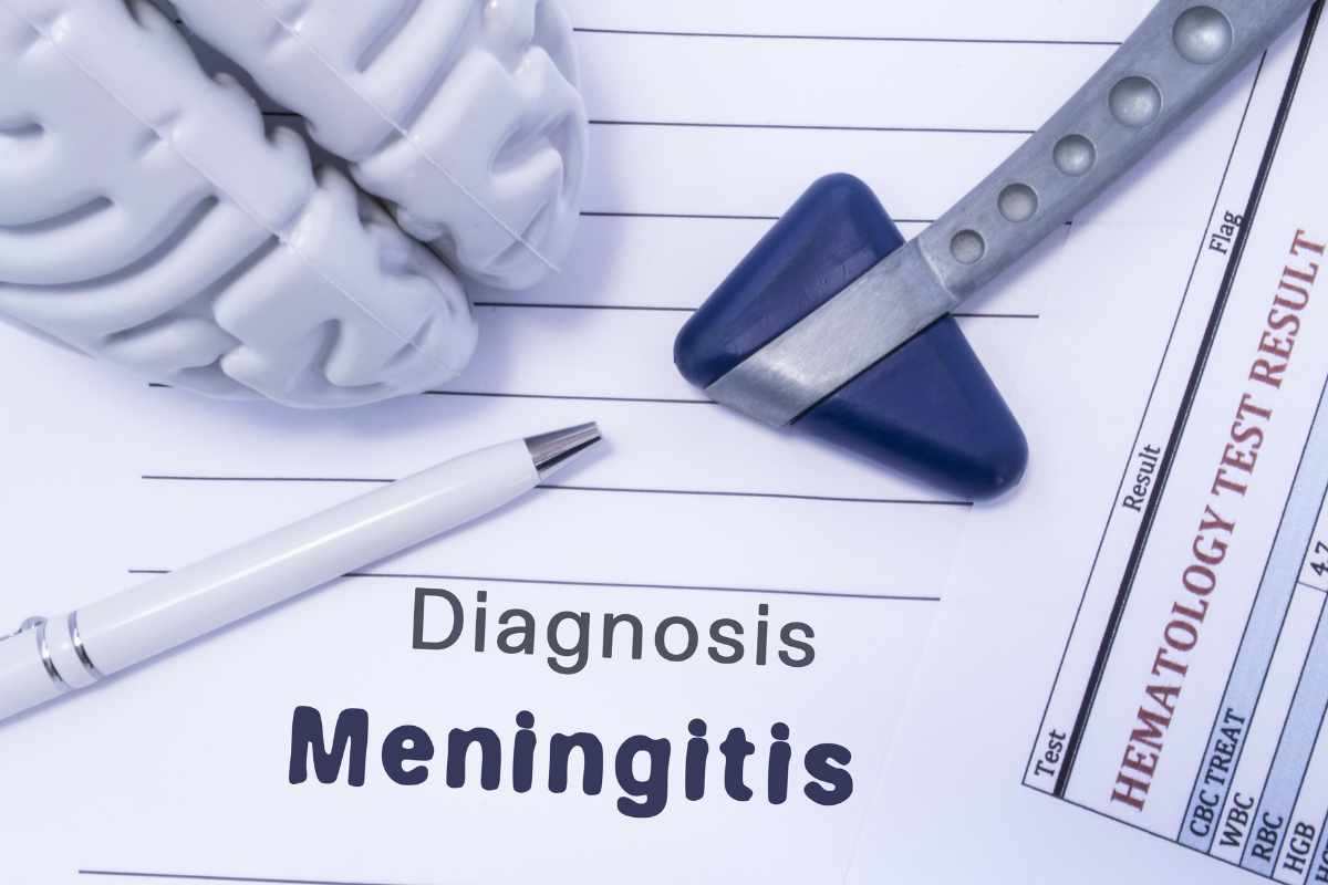 casi in aumento di meningite